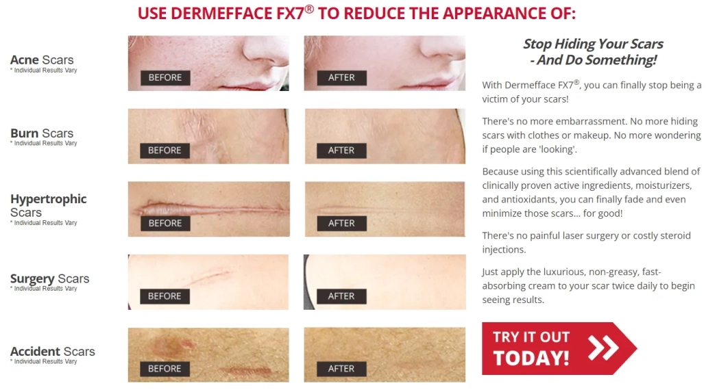 dermeffacefx7-before-and-after