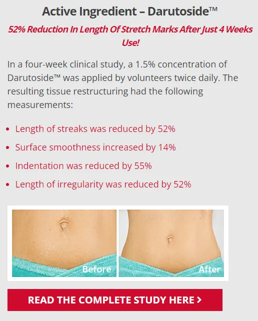 intensive-stretch-mark-therapy-skinception-active-ingredient-darutoside