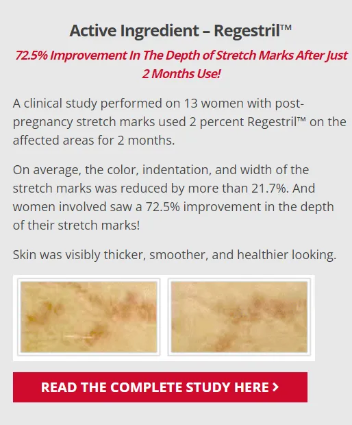 intensive-stretch-mark-therapy-skinception-active-ingredient-regestril