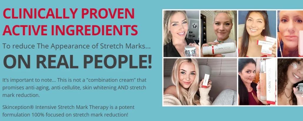intensive-stretch-mark-therapy-skinception-user-testimonials