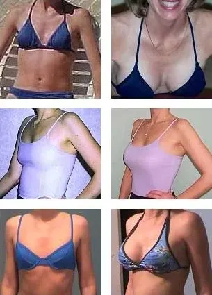 Breast-Actives-Before-and-After