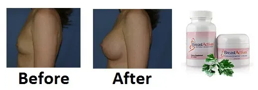 Breast-Actives-before-and-after1