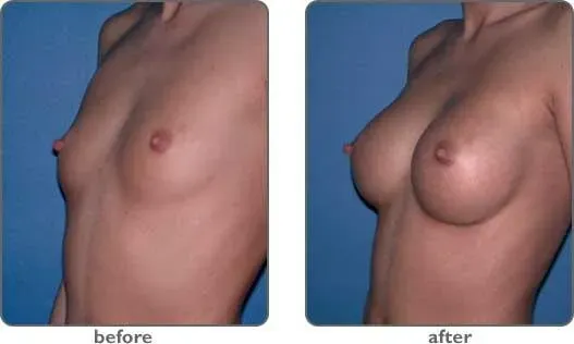 breast-actives-results