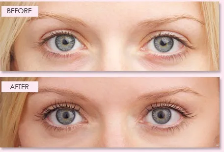 idol-lash-before-after