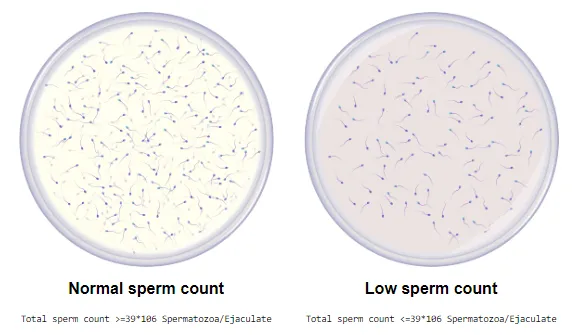 Fertility Factor 5 - improve sperm