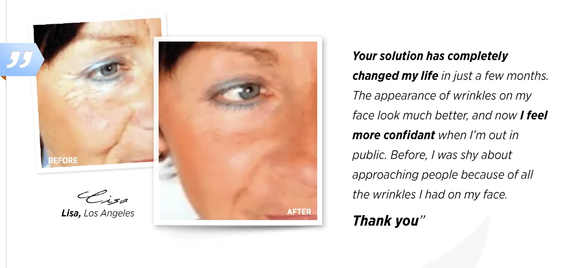 11 Unrivaled Benefits of California Bioenergy Skin Care: A New Horizon in Beauty and Wellness 11 california-bioenergy-skin-before-after