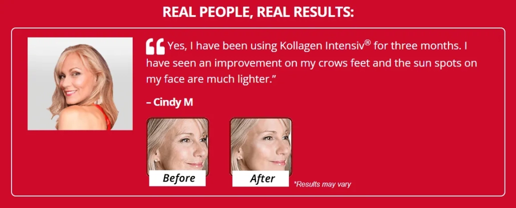 kollagen-intensiv-real-people-real-results-before-and-after