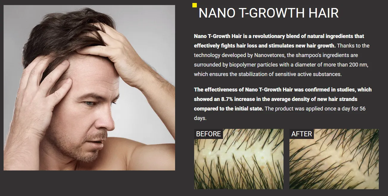 Folicerin: 14 Unique Advantages for Superior Hair Health 10 folicerin nano t growth hair