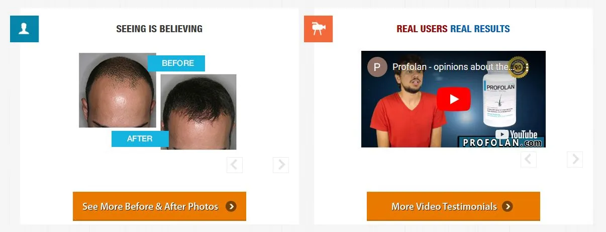 Profolan before and after real results