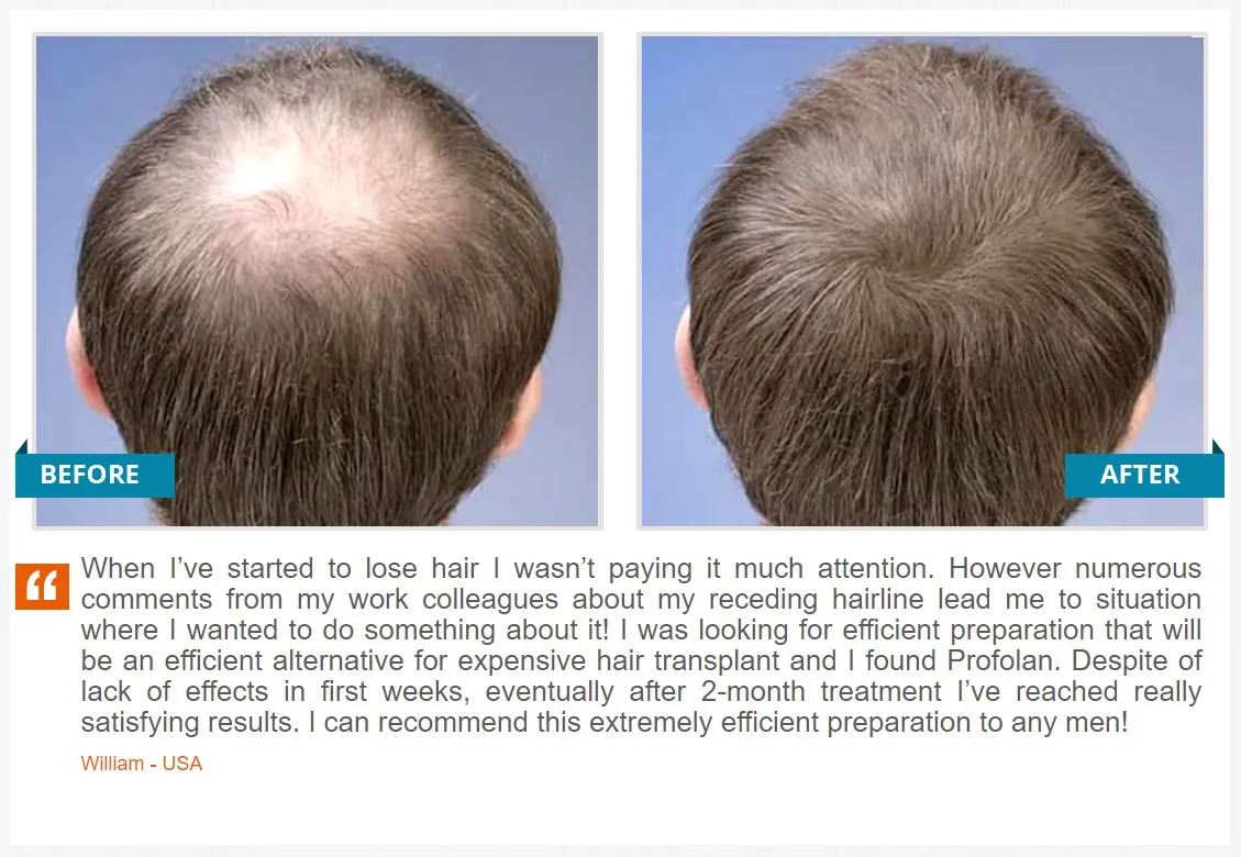 Profolan user reviews and testimonials before and after
